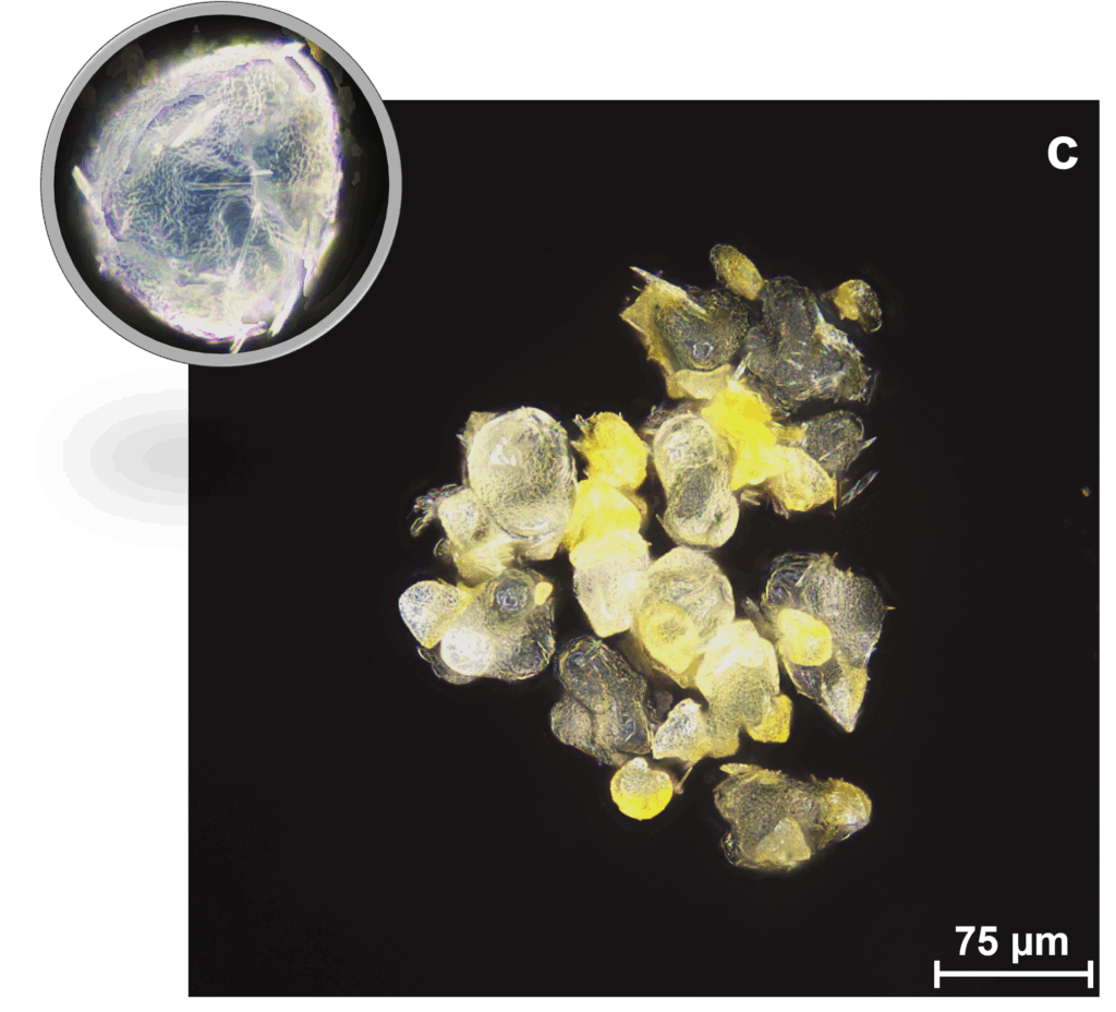 Microscopic Marvels: A Pollen Deep Dive - Fremont, California - JH ...
